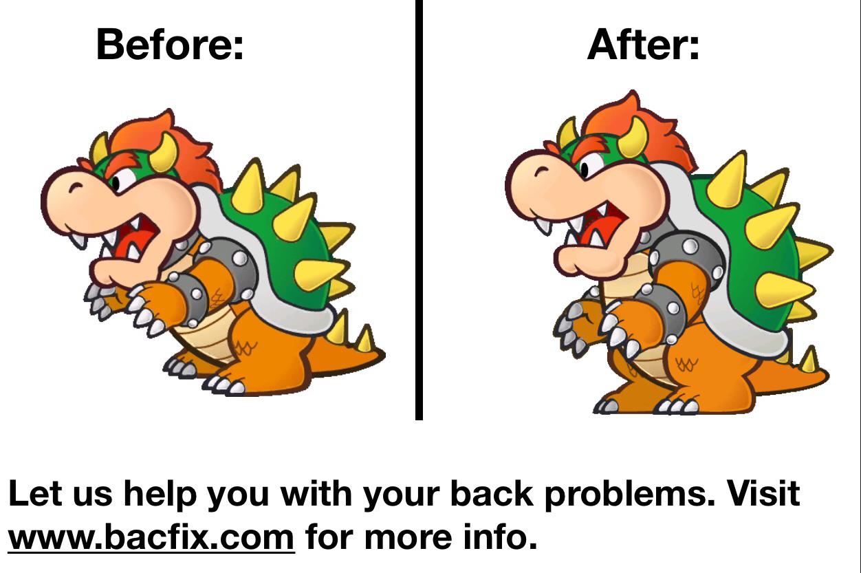 Bowser's erect...posture..